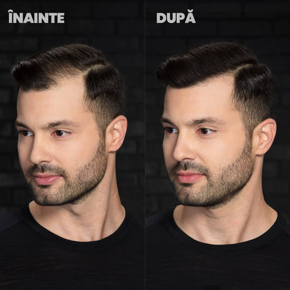 Nanofibre Toppik 12g + Fixativ Fiberhold = Păr vizibil mai des în câteva secunde – fără operații, fără trucuri!