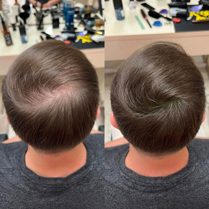 Nanofibre Toppik 12g + Fixativ Fiberhold = Păr vizibil mai des în câteva secunde – fără operații, fără trucuri!