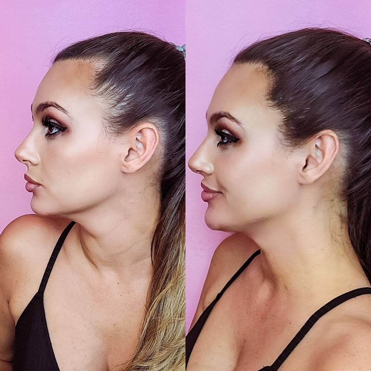 Nanofibre Toppik 12g + Fixativ Fiberhold = Păr vizibil mai des în câteva secunde – fără operații, fără trucuri!