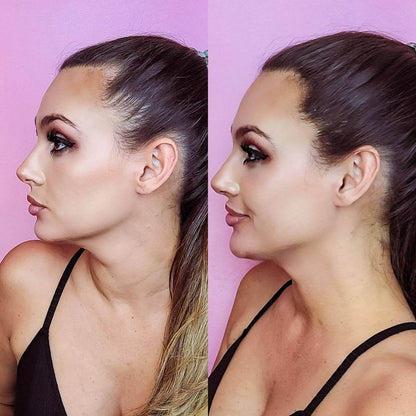 Nanofibre Toppik 12g + Fixativ Fiberhold = Păr vizibil mai des în câteva secunde – fără operații, fără trucuri!