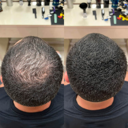 Nanofibre Toppik 12g + Fixativ Fiberhold = Păr vizibil mai des în câteva secunde – fără operații, fără trucuri!