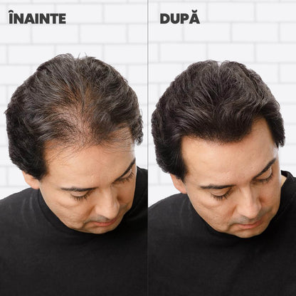 Nanofibre Toppik 12g + Fixativ Fiberhold = Păr vizibil mai des în câteva secunde – fără operații, fără trucuri!