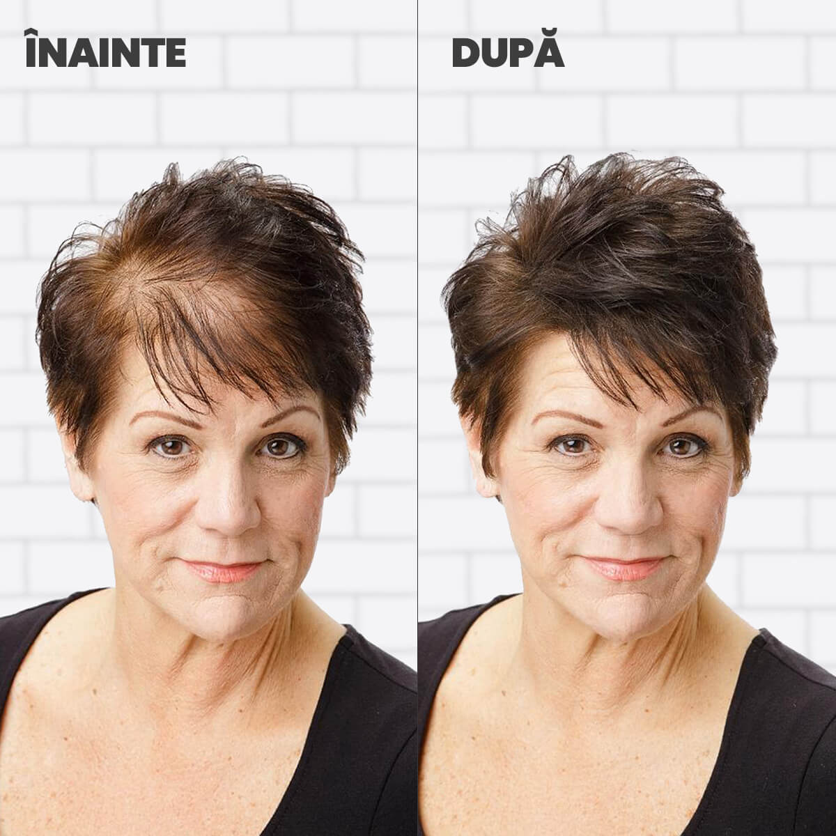 Nanofibre Toppik 12g + Fixativ Fiberhold = Păr vizibil mai des în câteva secunde – fără operații, fără trucuri!