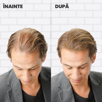 Nanofibre Toppik 12g + Fixativ Fiberhold = Păr vizibil mai des în câteva secunde – fără operații, fără trucuri!