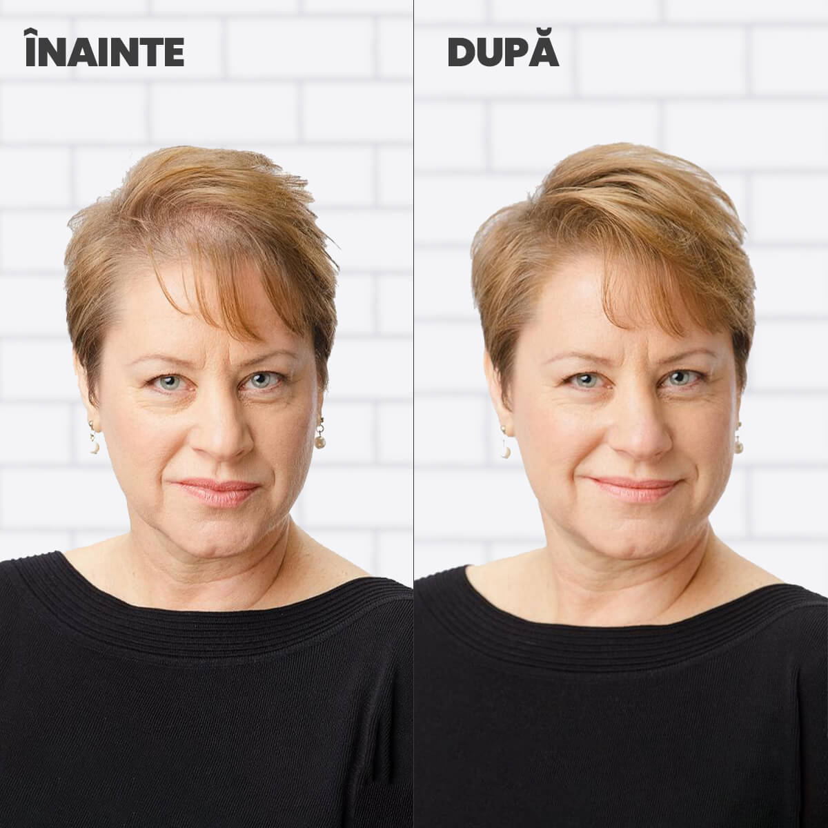 Nanofibre Toppik 12g + Fixativ Fiberhold = Păr vizibil mai des în câteva secunde – fără operații, fără trucuri!