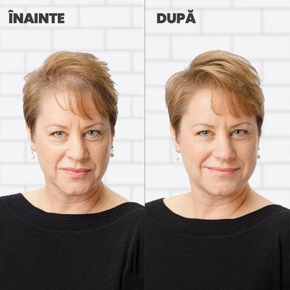 Nanofibre Toppik 12g + Fixativ Fiberhold = Păr vizibil mai des în câteva secunde – fără operații, fără trucuri!