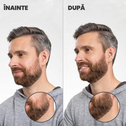 Nanofibre Toppik 12g + Fixativ Fiberhold = Păr vizibil mai des în câteva secunde – fără operații, fără trucuri!